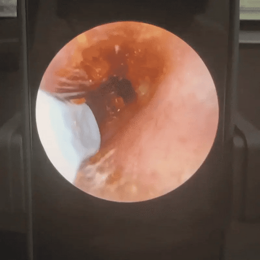 EarBuddy™